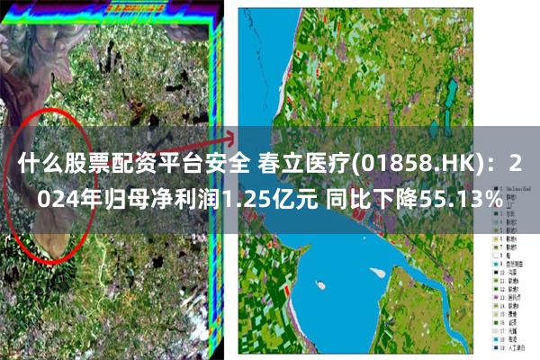 什么股票配资平台安全 春立医疗(01858.HK)：2024年归母净利润1.25亿元 同比下降55.13%